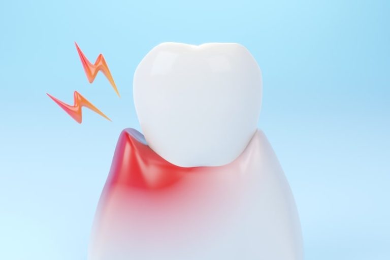 The effects of gum disease around a tooth